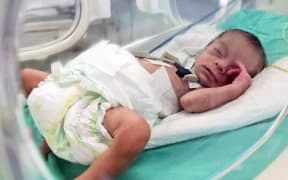 A premature baby in a neonatal unit at a hospital in Khan Younis, Gaza Strip on 23 October, 2023. (Photo by YOMIURI SHIMBUN / Yomiuri / The Yomiuri Shimbun via AFP)