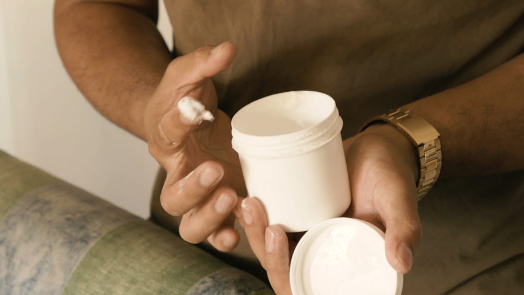 Te Kou o Rehua Panapa using the "betaclom" cream - a mix of a steroid and an antifungal cream to treat his son's eczema.
