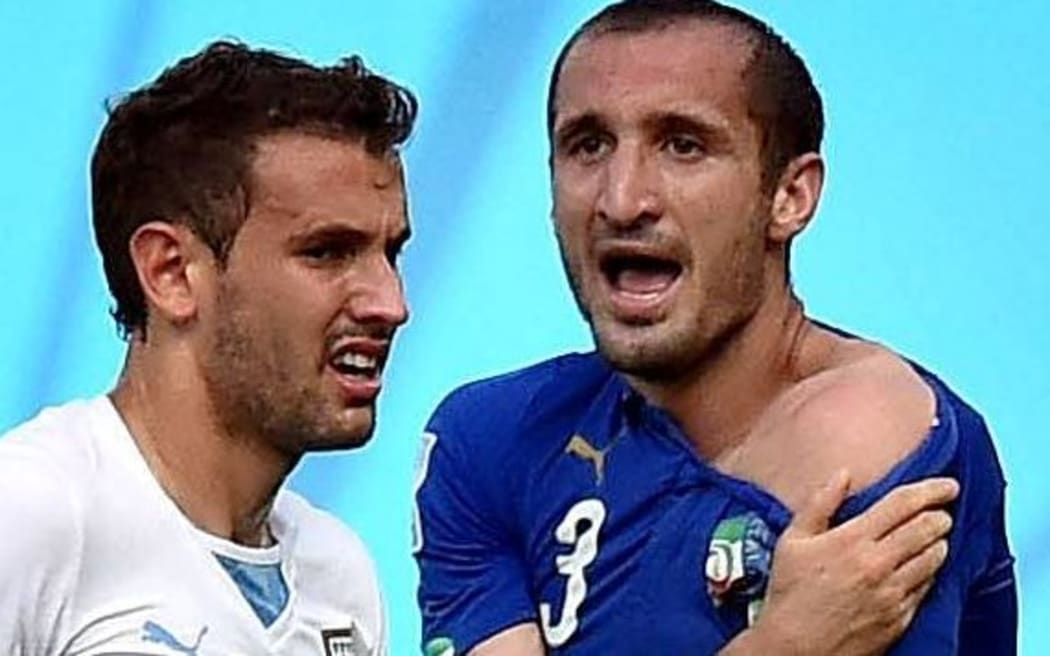 Italian footballer Chiellini claims Uruguay's Luis Suarez has bitten him.