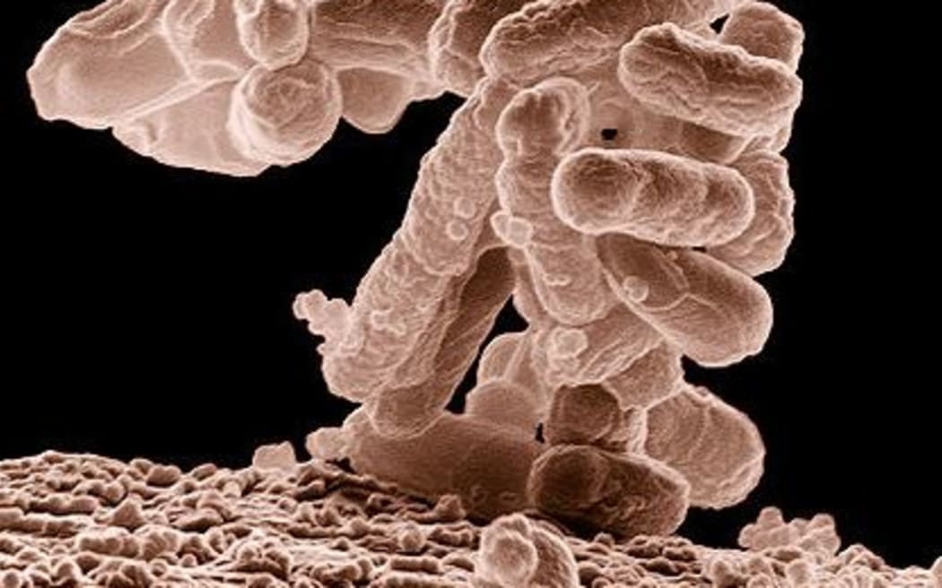 A low-temperature electron micrograph showing a cluster of E. coli bacteria, magnified 10,000 times. Each individual bacterium is oblong shaped.