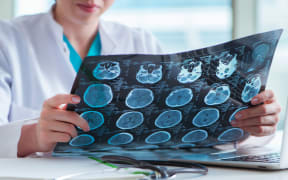The doctor examining MRI image in hospital.