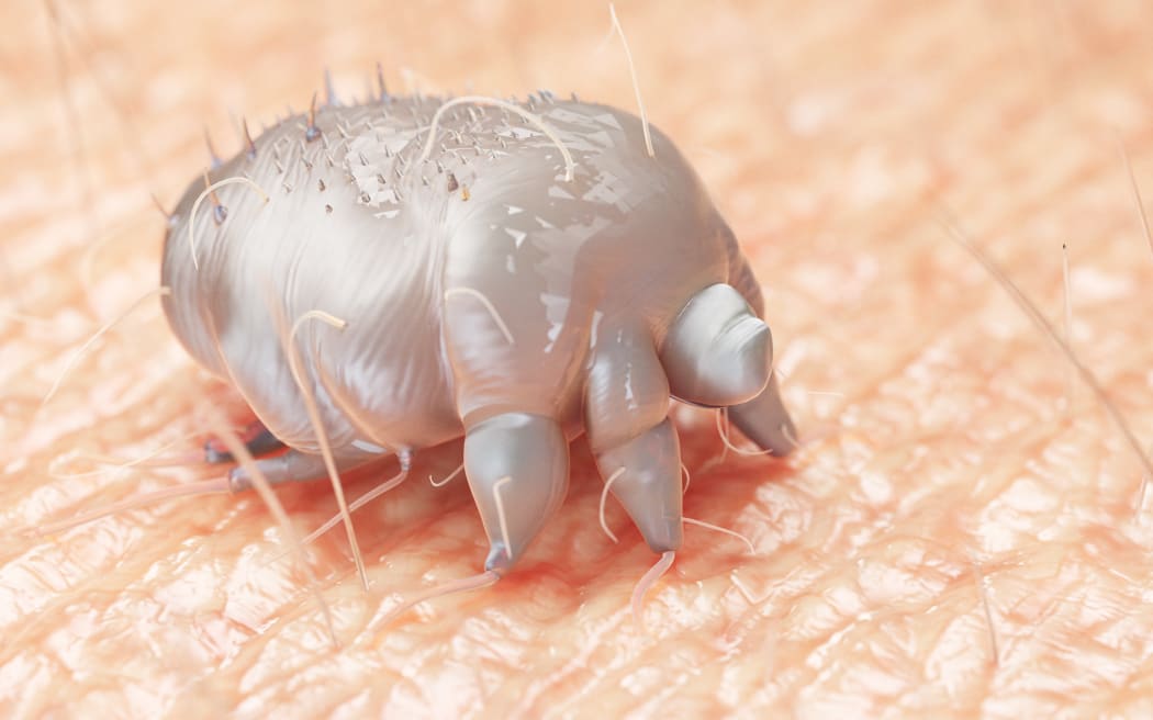 Illustration of a scabies mite on human skin.