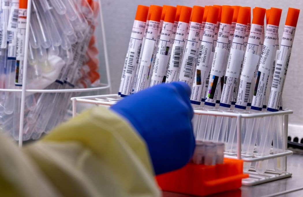 01 February 2022, Mecklenburg-Western Pomerania, Greifswald: Medical technical assistant Denise Dittmar pipettes swab samples from test centers and prepares them for further examination in the automated machine in the PCR laboratory