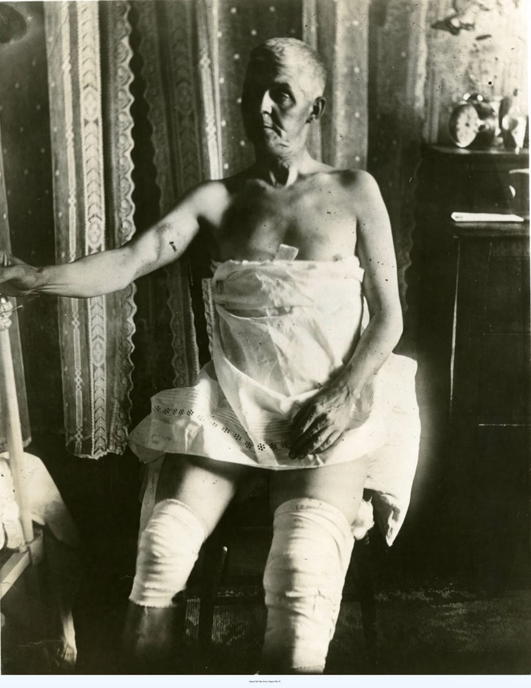 Bobby Leach post-Niagara Falls