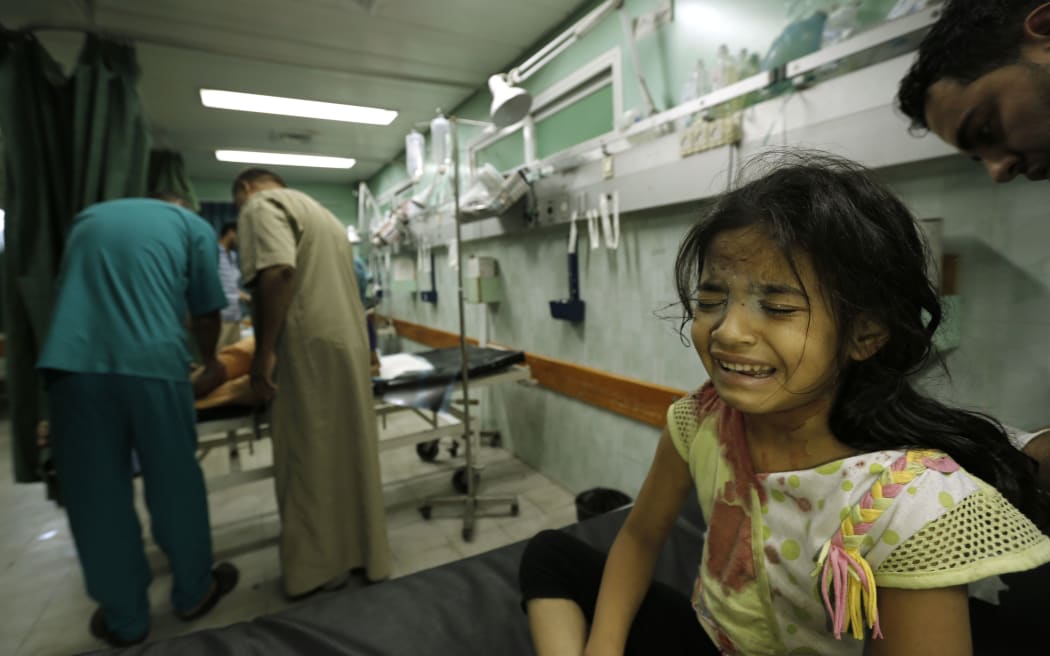 A Palestinian girl receiving treatment at a hospital near the shelled UN-run school.