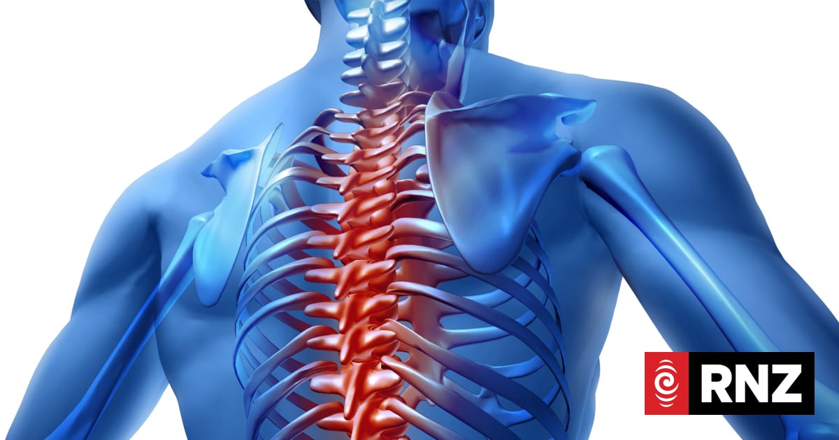 Man not told he would have implant of dead person's bone | RNZ