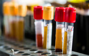 Blood samples with Hepatitis B and C viruses in a hospital in France