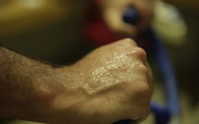 Sweat on back of Simon's hand