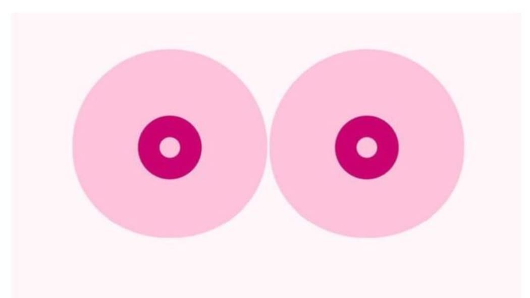 Facebook has apologised for removing a video on breast cancer awareness posted by a Swedish group, saying it was incorrectly taken out.