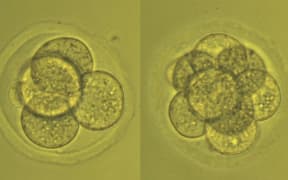 Fertility researcher Melanie Olds photographed a very early embryo as it doubled from two to eight cells.