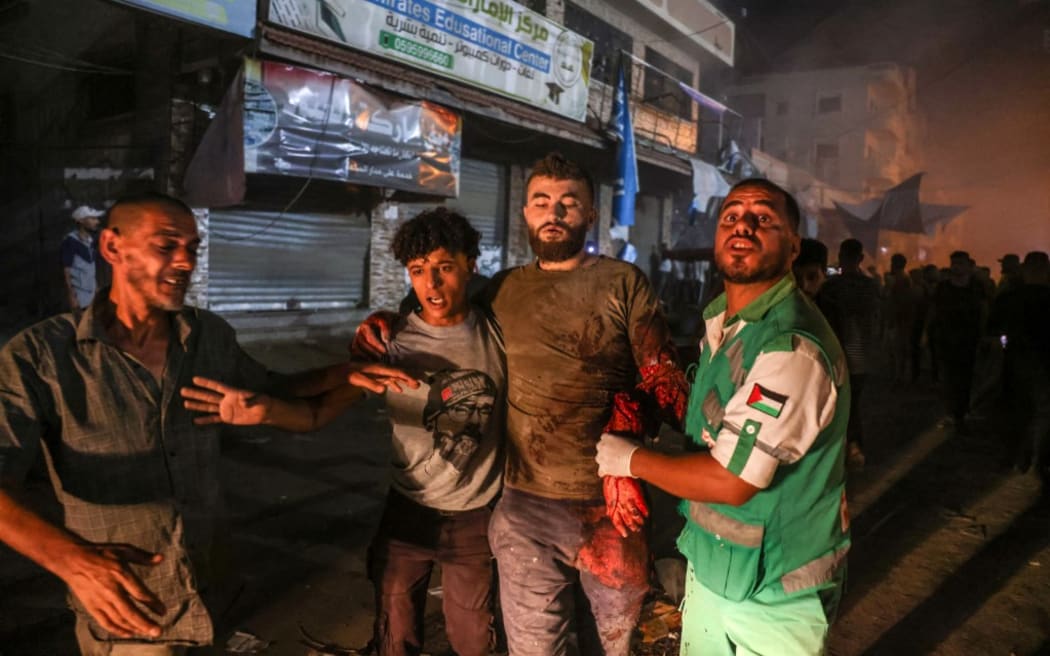 Palestinians help a man injured in an Israeli strike that targeted a mosque-turned-shelter in Deir al-Balah in the central Gaza Strip, during the night of October 6, 2024, amid the ongoing war between Israel and the Palestinian Hamas movement. Gaza's civil defence agency said on October 6 that an Israeli strike on the mosque-turned-shelter in central Deir al-Balah killed 21 people, while Israel's military said it had targeted Hamas militants. (Photo by BASHAR TALEB / AFP)