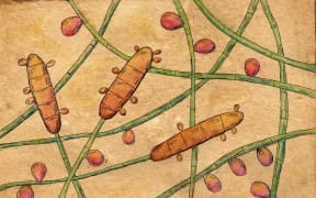 Illustration of Trichophyton rubrum fungi, showing macroconidium, microconidia and septate hyphae. This fungus infects skin and nails causing dermatophytosis and onychomycosis. (Photo by KATERYNA KON/SCIENCE PHOTO LIBRA / KKO / Science Photo Library via AFP)