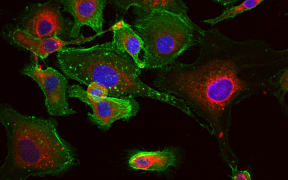 RNA Nanoparticles in Cancer Cells