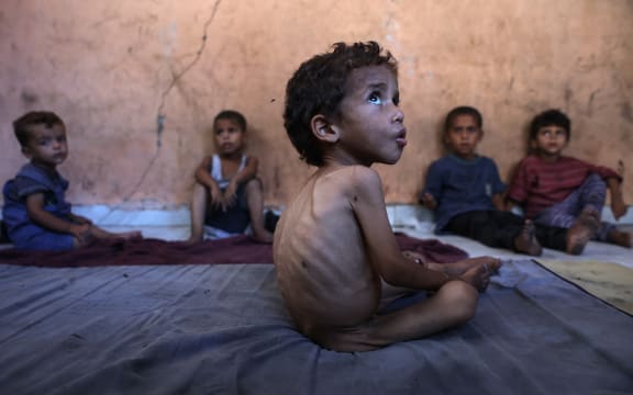 Yazan, a malnourished 2-year-old Palestinian boy, sit with his brothers at their family's damaged home in the Al-Shati refugee camp, west of Gaza City.