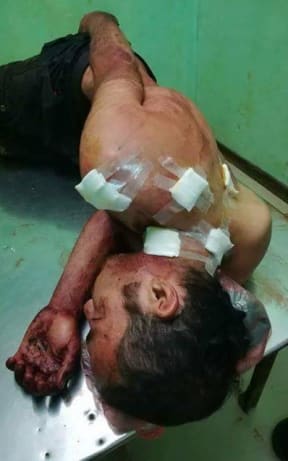 The refugee after the screwdriver attack.