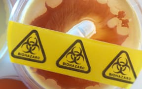 Antibiotic testing in a petri dish (file photo)