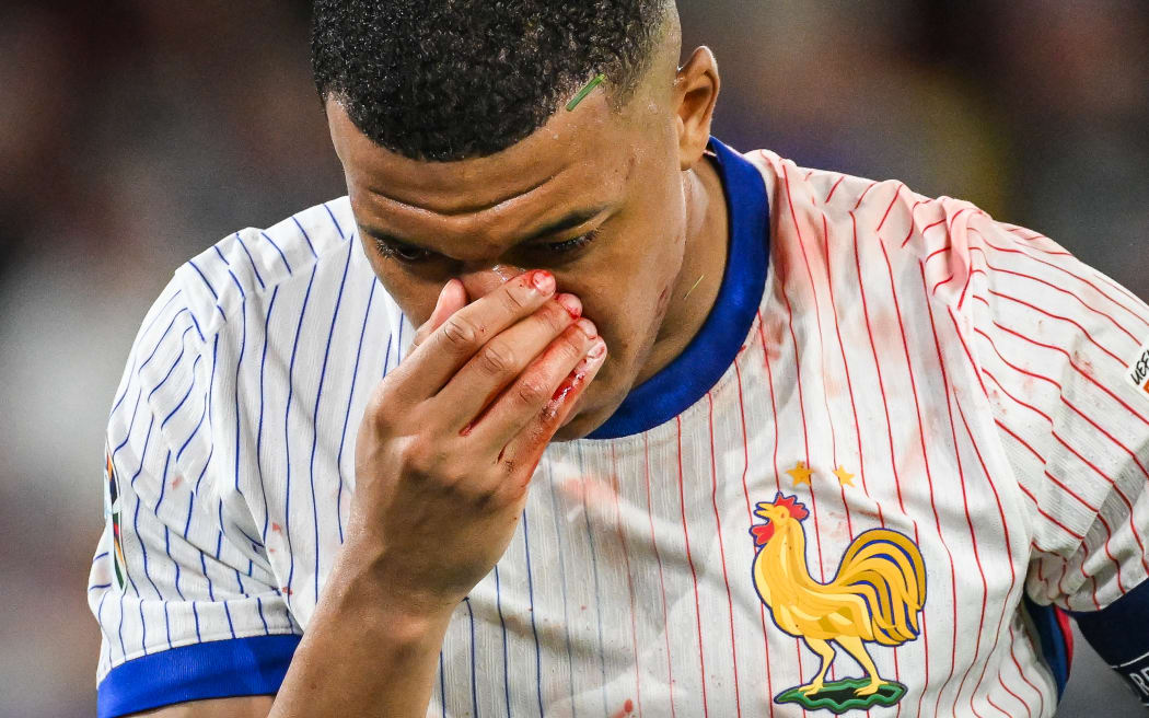 Kylian Mbappe of France is injured during the UEFA Euro 2024, Group D, football match between Austria and France, 2024.