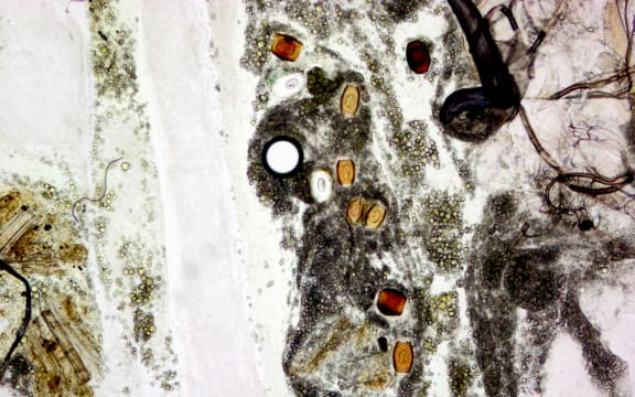 A microscope image of some cysts inside an insect host. You can see different cells and tissues of the insect, as well as the cysts which look like small orange pellets with a translucent centre.