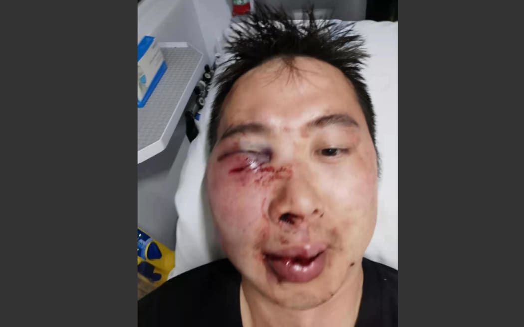 The man who was attacked at the Wai-o-Tapu thermal pools was left with injuries to his face.