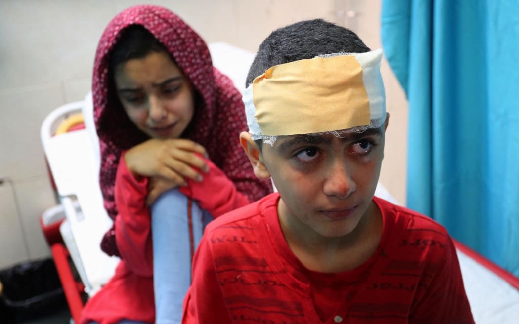 GAZA CITY, GAZA - MAY 15: Kids injured in Israeli attack carried out to home of Palestinian Abu Khatab Familiy living in Al-Shati Camp in Gaza Strip, receive treatment at Shifa Hospital on May 15, 2021, in Gaza City, Gaza.