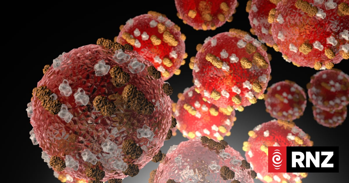 Measles case detected in Palmerston North with no known source