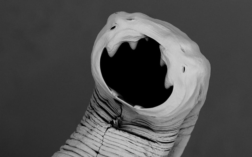 A photo of a hookworm taken with extreme magnification, showing the hookworm's mouth with teeth-like appendages.