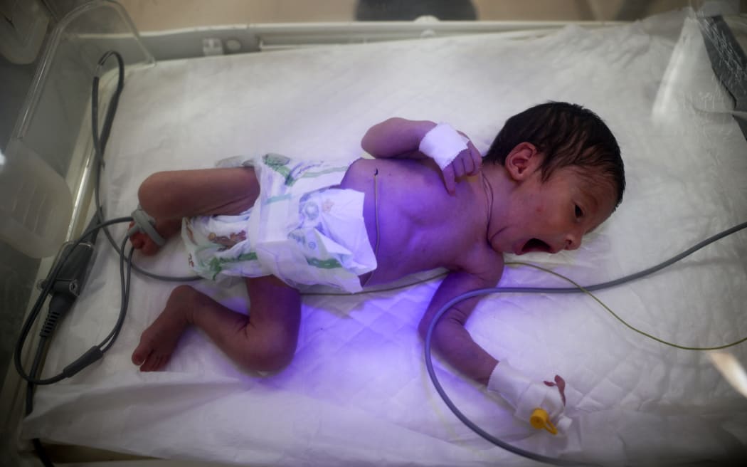 A prematurely born baby lies inside an infant incubator at the al-Aqsa Martyrs hospital in Deir el-Balah in the central Gaza Strip on 15 March, 2025, almost a week after Israel cut off the electricity supply from the Gaza Strip.