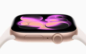 A close-up of purple patterns on a digital watch screen.