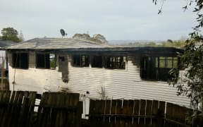 A person is in hospital with dog bite injuries following a house fire in the Auckland suburb of Massey.