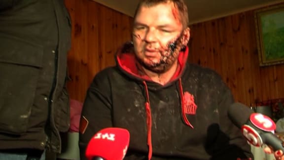 Ukrainian opposition activist Dmytro Bulatov being interviewed in Kiev. Bulatov was found severely beaten with multiple knife wounds, after apparently being tortured for days. The 35-year-old activist from the Avtomaidan group organised protests.