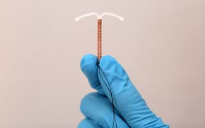 Doctor holding T-shaped intrauterine birth control device.