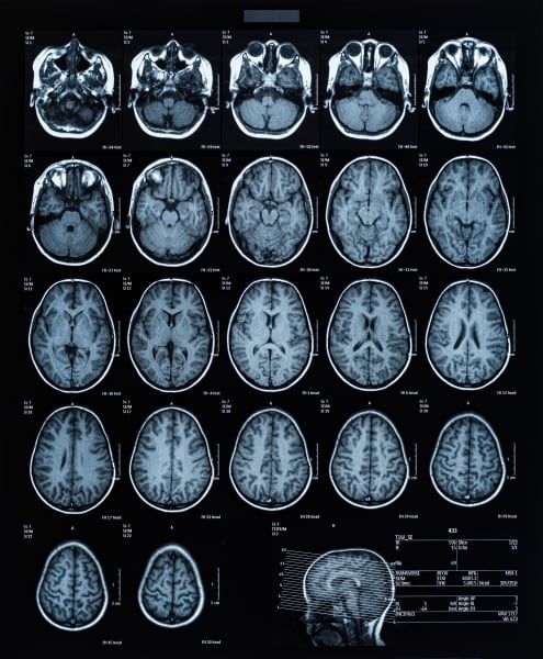 health medical image of an mri of the head showing the brain. Magnetic resonance image.