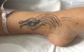 A photo of the critically injured woman's tattoo.