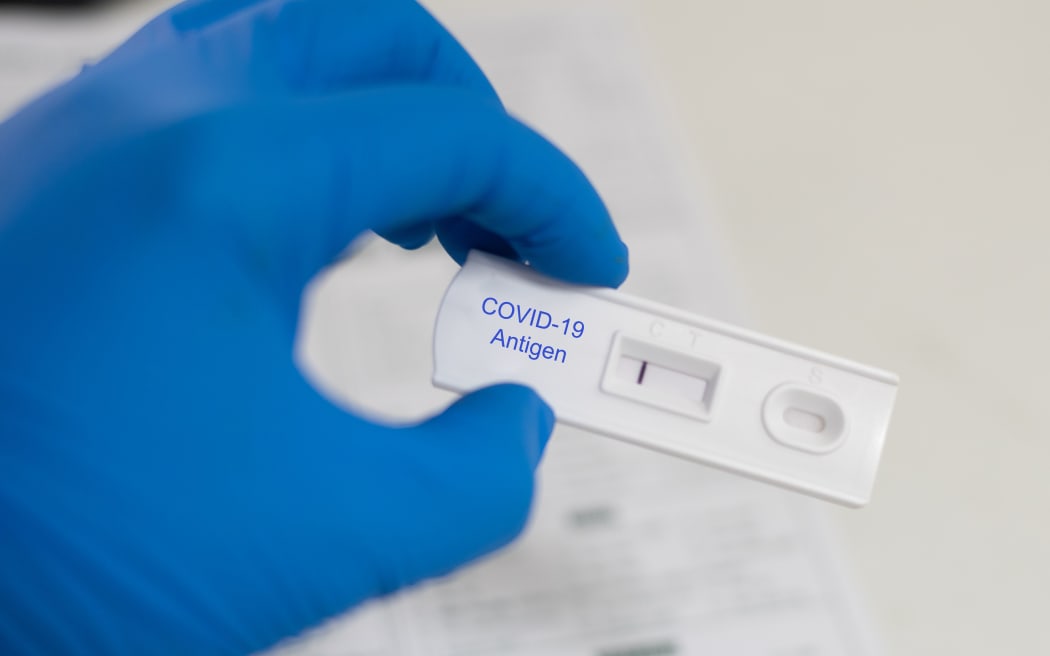 Strip Screening rapid test COVID-19 antigen negative.Testing in biosafty cabinet class 3.
