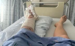 Georgina Lloyd's broken leg