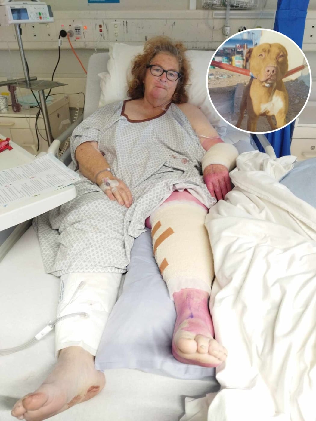 Carol Stewart was left with horrific injuries after a dog pulled her off her scooter in Murraee Street, Wairoa. Inset: The dog that attacked her has been euthanised.