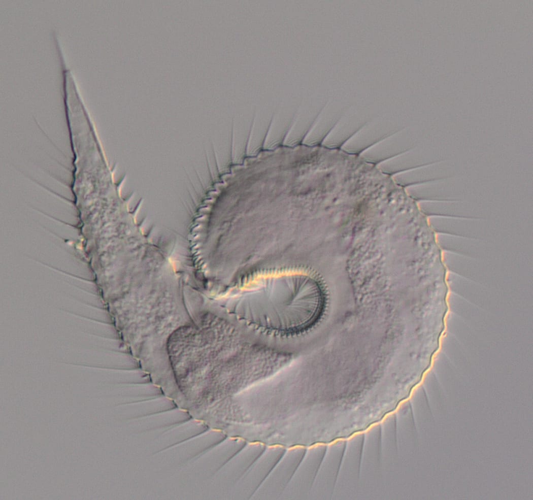 Tiny worm curved into a ball with spines around the otuside