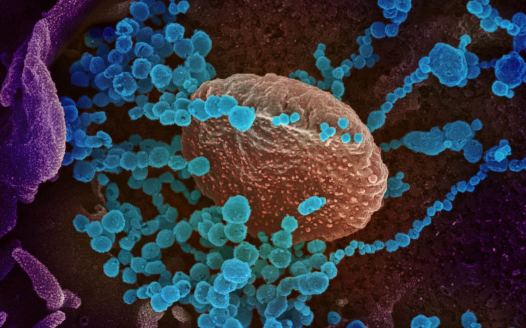 A scanning electron microscope image showing SARS-CoV-2 emerging from the surface of cells cultured in the lab.