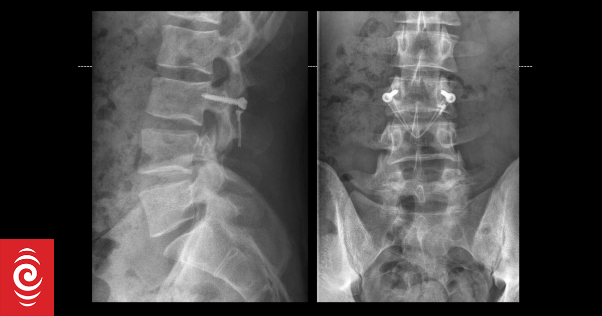 Kiwi surgeon Dr Rowan Schouten behind international cricketers' returns