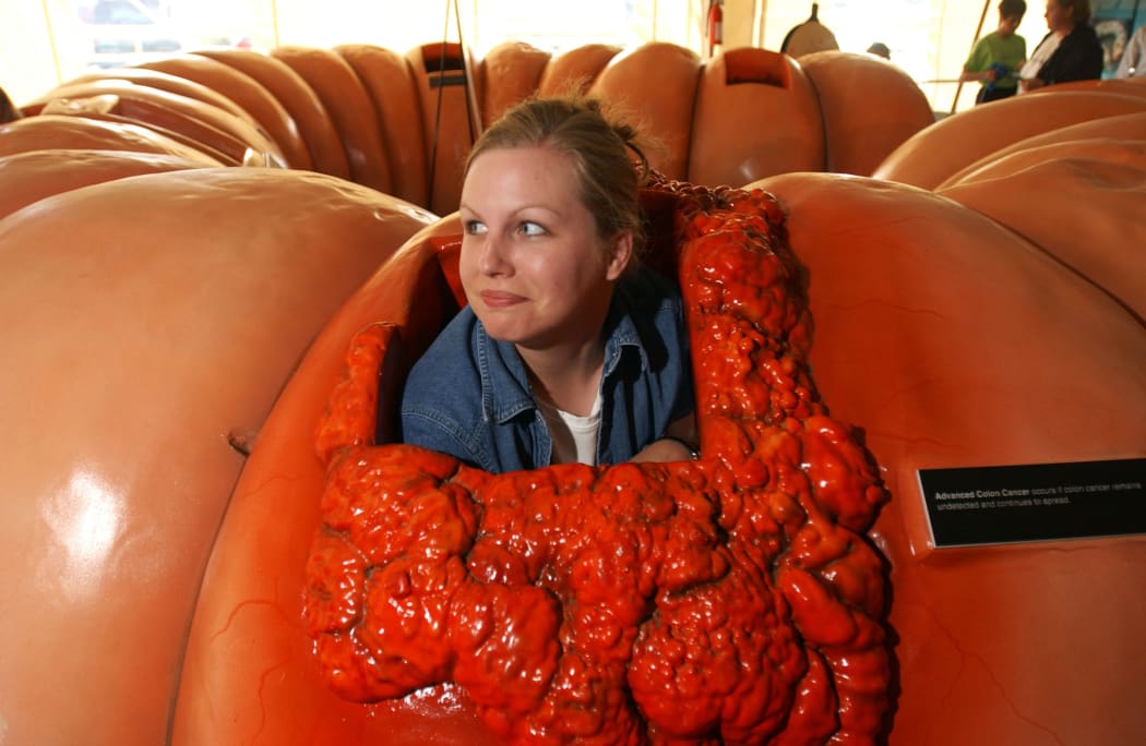 Dawn Mason peeps her head up while crawling through a 12 metre long replica of a human colon in Seattle.