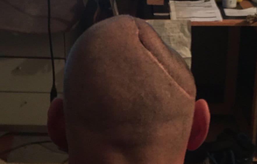 Benjamin Lightbody was attacked in Mt Eden prison in 2013.