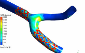 Computer models of blood flowing through a coronary artery.