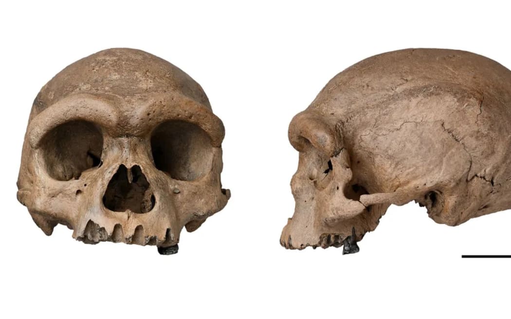 A skull stashed at a bottom of a well for about 90 years in Harbin, in China's Heilongjiang province, recently resurfaced and has been studied by experts in human origins.