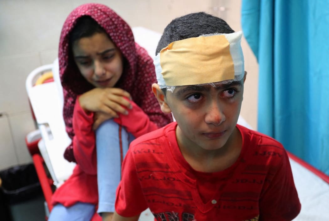 GAZA CITY, GAZA - MAY 15: Kids injured in Israeli attack carried out to home of Palestinian Abu Khatab Familiy living in Al-Shati Camp in Gaza Strip, receive treatment at Shifa Hospital on May 15, 2021, in Gaza City, Gaza.