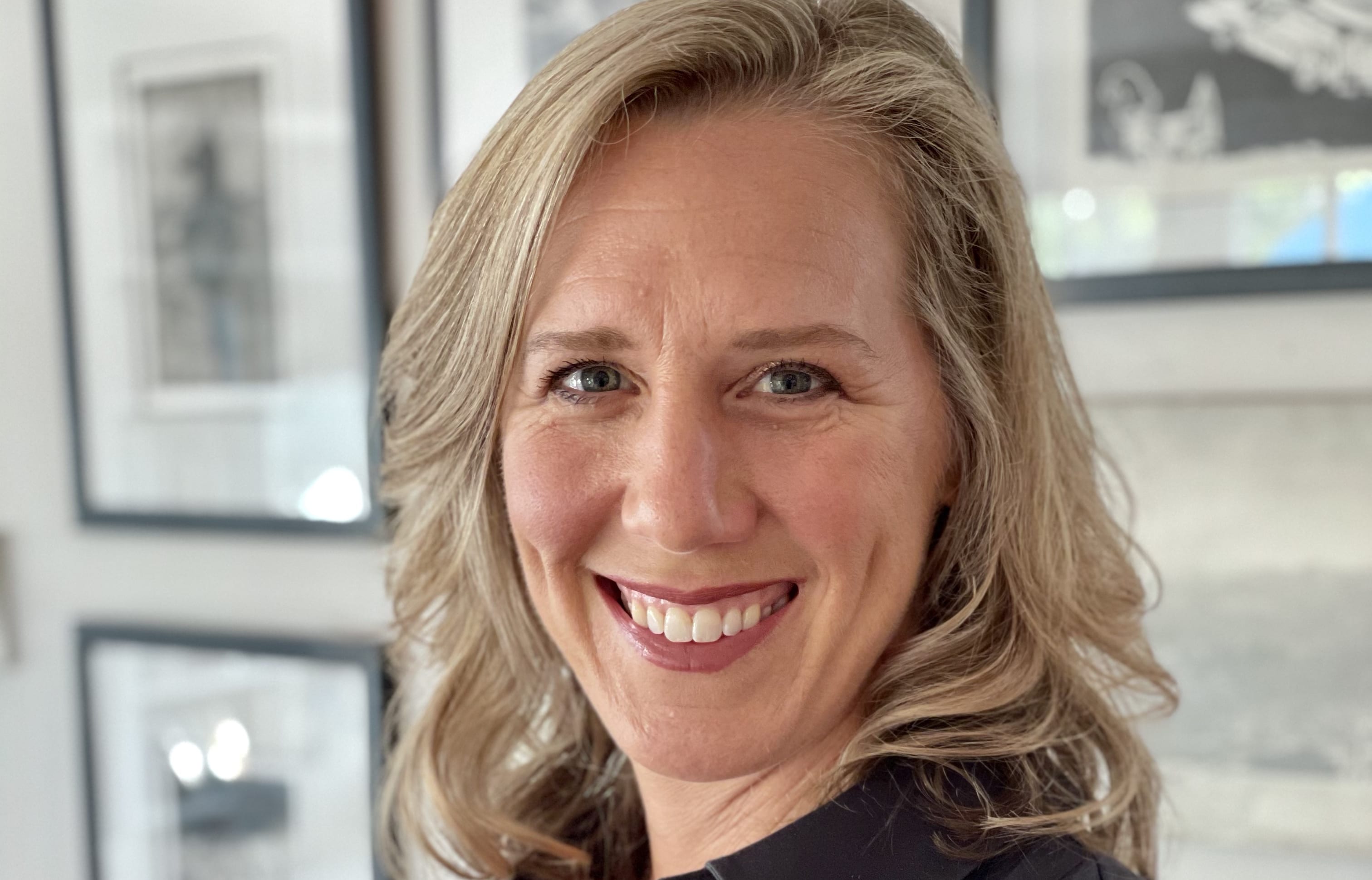 Obstetrician Michelle Wise believes ACC's stance on severe tears is "too restrictive" because the international research on what causes them is inconclusive