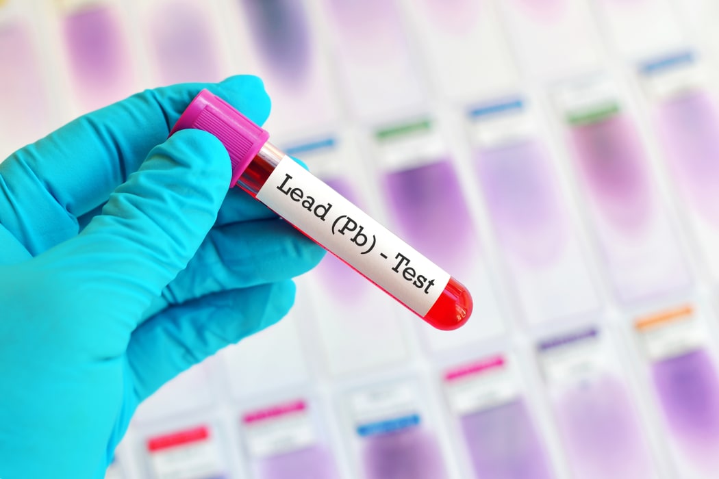 A study by UNICEF says about 800 million children worldwide could be affected by lead poisoning. It says lead is a potent neurotoxin which causes irreparable harm to children’s brains, and can cause an increase in crime and violence.