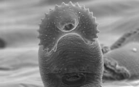 Worm just out of its cyst