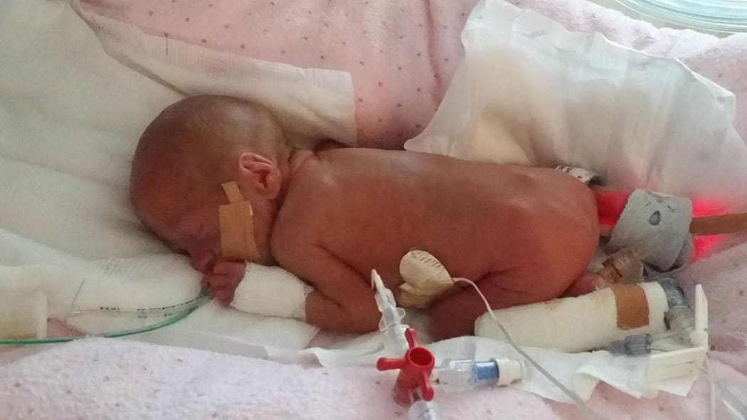 Frankie, who was born at 24 weeks and 3 days, weighing 650 grammes. She was part of Barbara’s study. Frankie is now thriving. The photo was supplied by Frankie’s family.