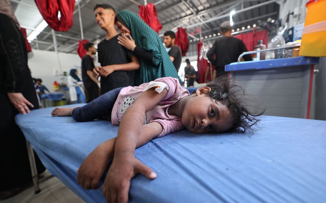 EDITORS NOTE: Graphic content / A woman and a child cry as a little girl lies on a hospital bed waiting for first aid treatment at Al-Awda Hospital at the Nuseirat refugee camp in the central Gaza Strip, following an Israeli airstrike that hit a school hosting Palestinian refugees in the camp on 19 May 2025.