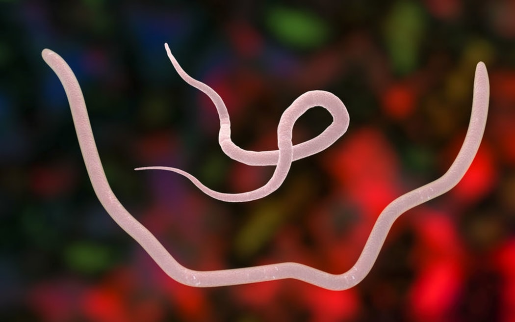 Gut worms may be healthy - research